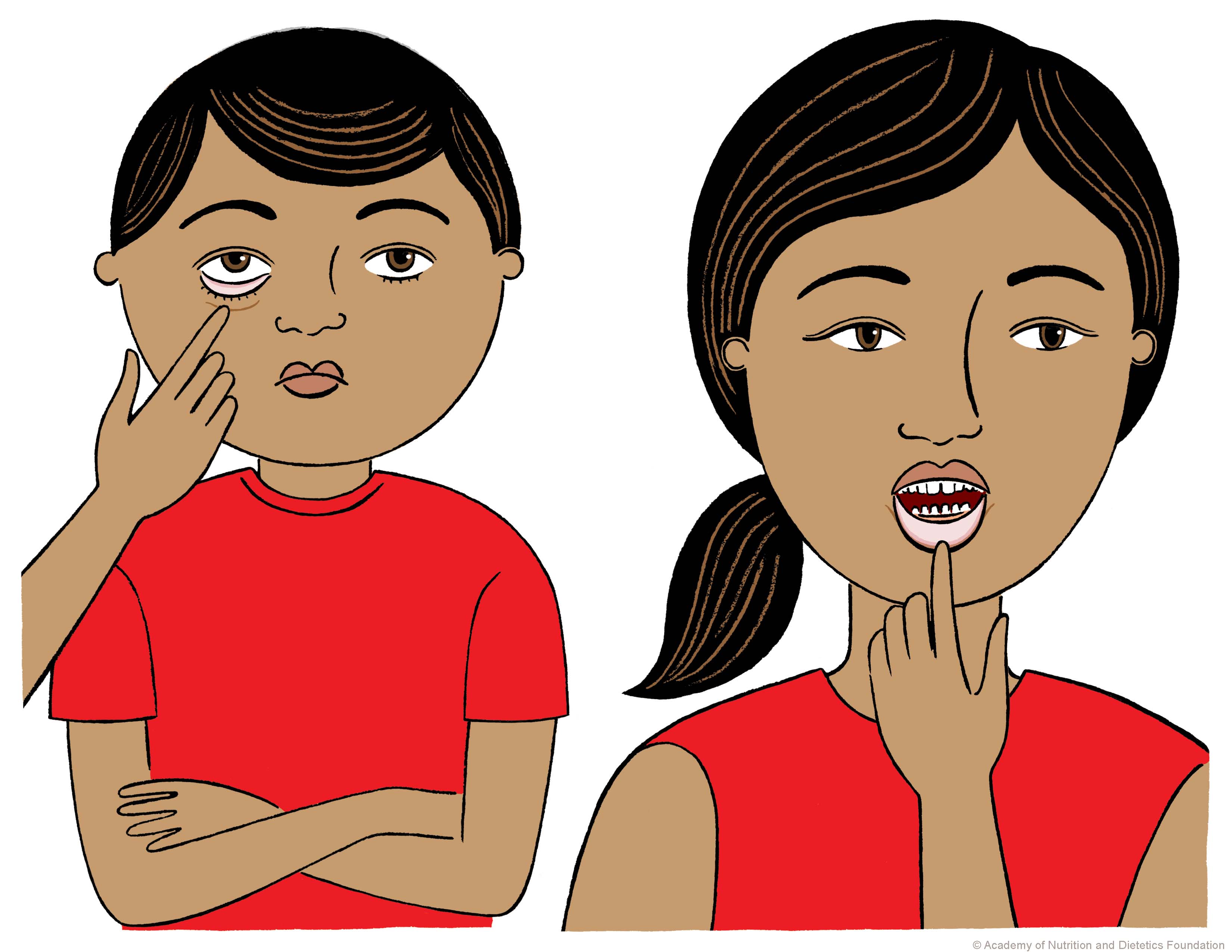 أعراض فقر الدم