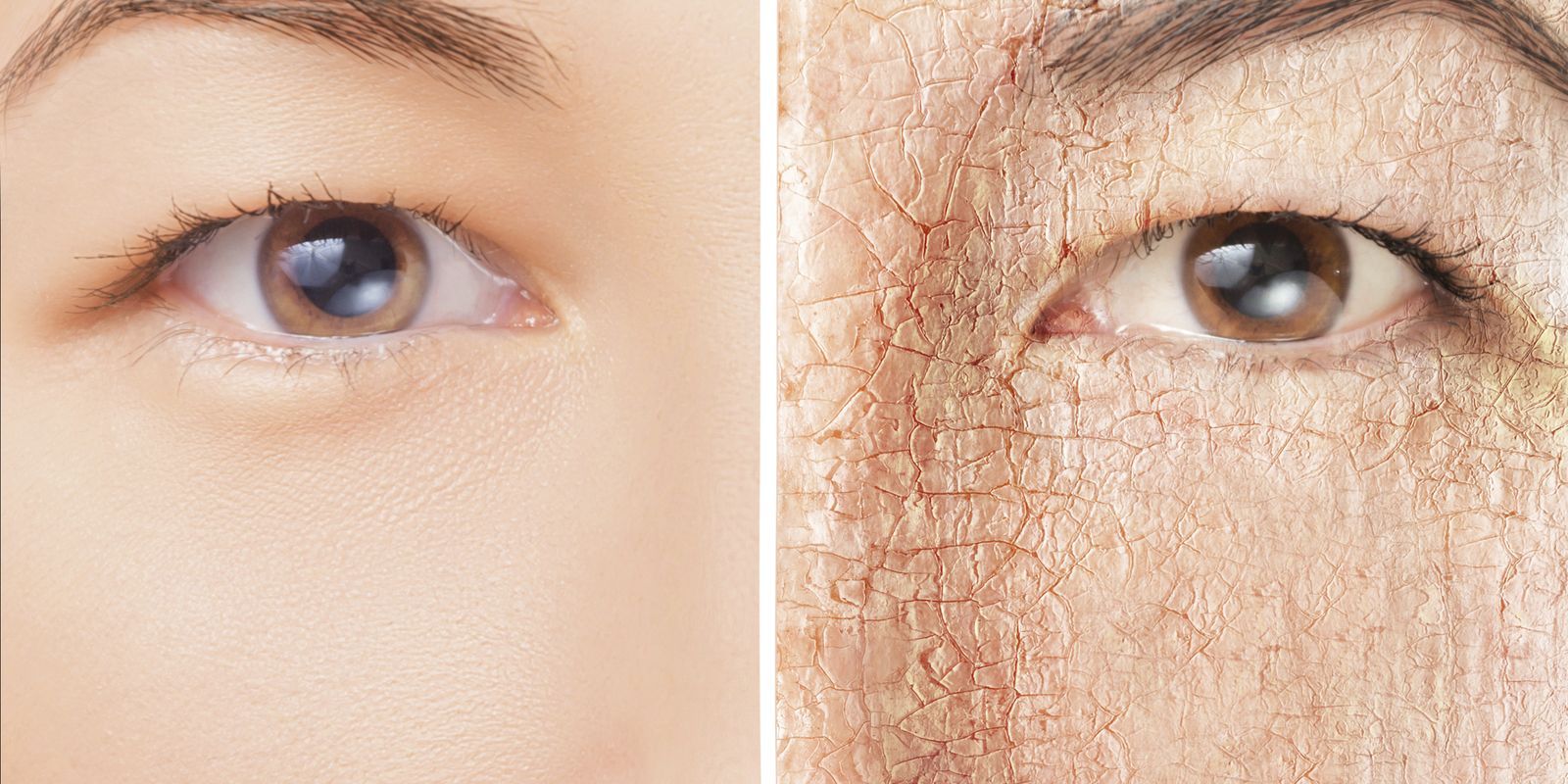 عناية بالبشرة الجافة