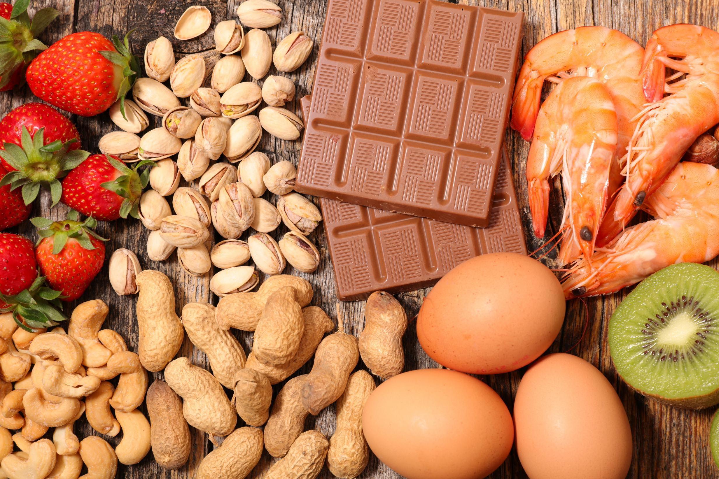 الحساسية الغذائية