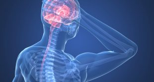 صداع خلف الراس