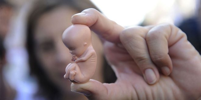 الاجهاض المبكر