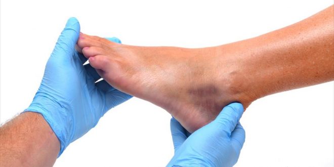 القدم السكري