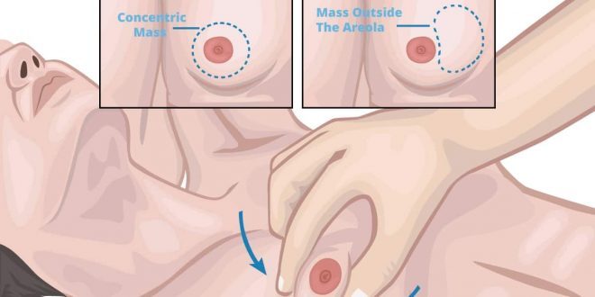 كبر الثدي عند الأولاد