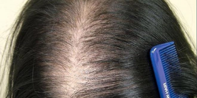 اسباب تساقط الشعر