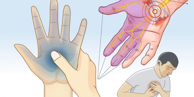 اسباب وخز اليدين