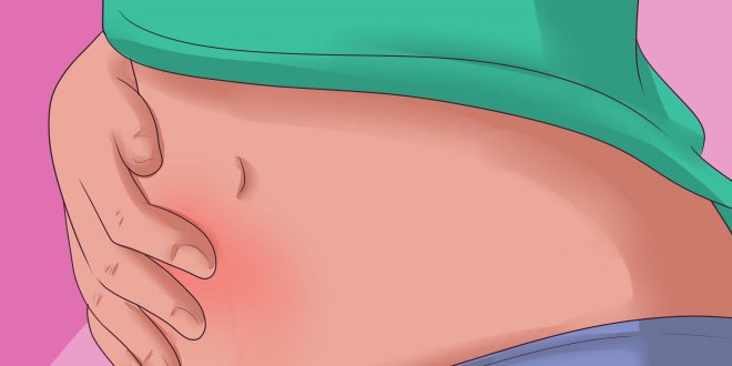 التهاب القولون