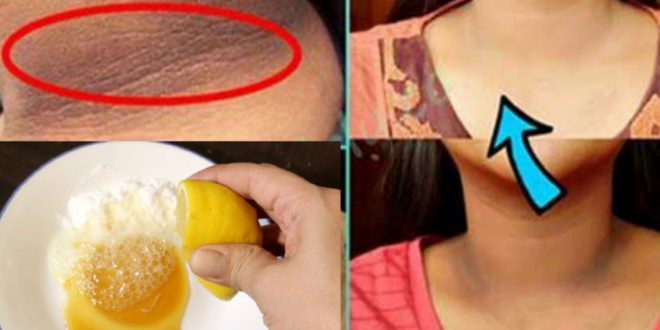 تبييض الرقبة