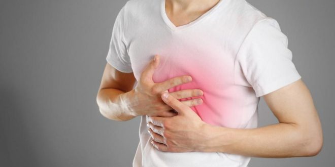 حرقة المعدة