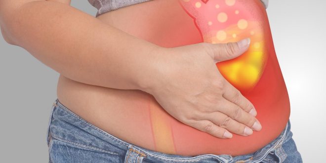 متلازمة زولينجر إليسون