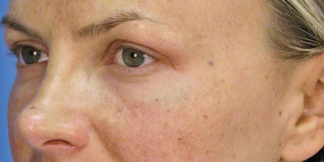 البقع الشمسية