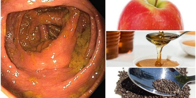 تنظيف القولون طبيعيا