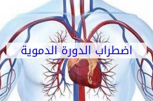 اضطراب الدورة الدموية