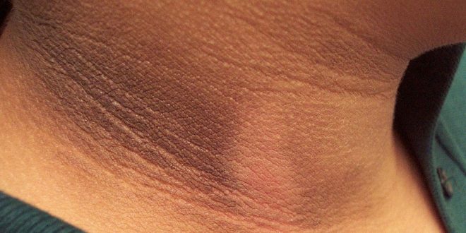 الشواك الأسود