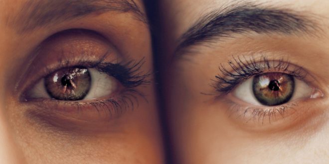 انتفاخ العيون