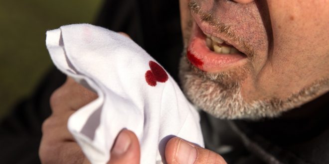 دم في السعال