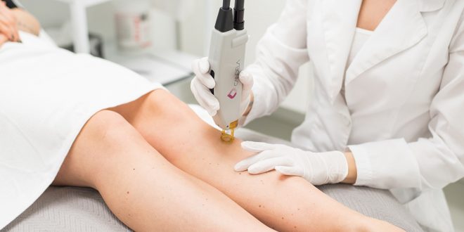 مخاطر ازالة الشعر بالليزر